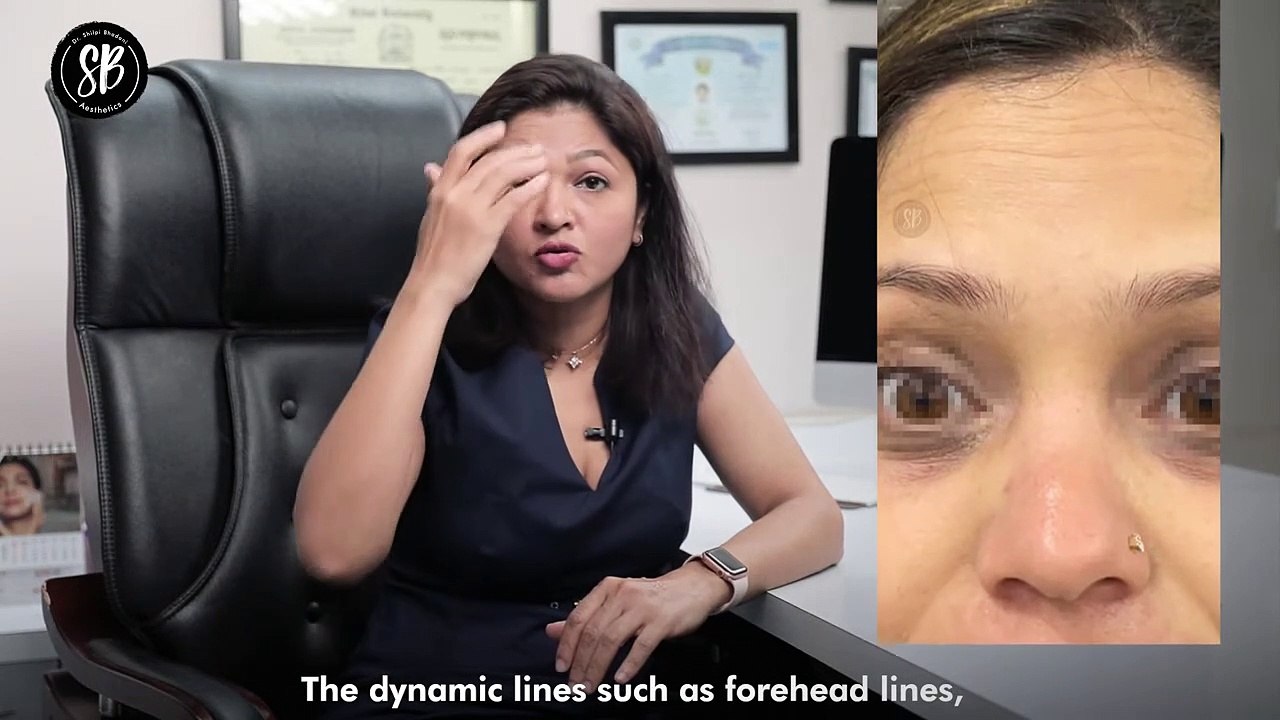 Dermal Fillers Explained (हिंदी में)