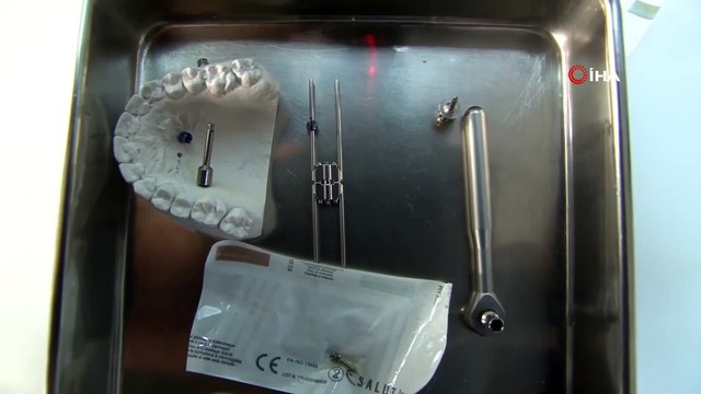 Bu Buluş Diş Hekimlerinin İşini Kolaylaştıracak