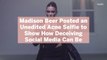 Madison Beer Posted an Unedited Acne Selfie to Show How Deceiving Social Media Can Be