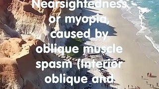 Nearsightedness or myopia