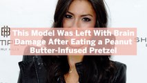 This Model Was Left With Brain Damage After Eating a Peanut Butter-Infused Pretzel—Here’s