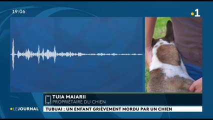 Tubuai : un enfant grièvement mordu par un chien