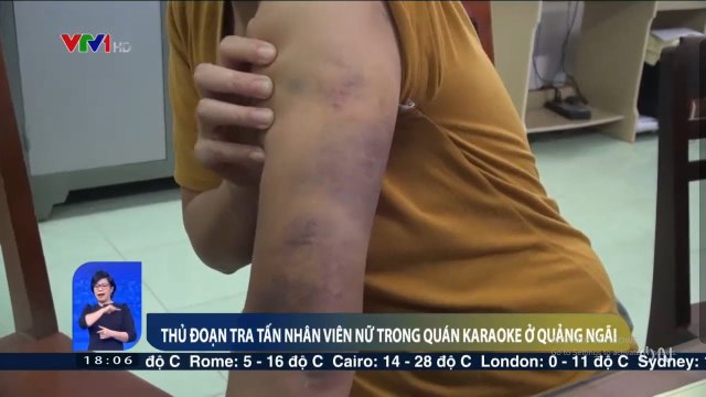THỦ ĐOẠN TRA TẤN NHÂN VIÊN NỮ TRONG QUÁN KARAOKE Ở QUẢNG NGÃI Tin tức 24h hôm nay mới nhất
