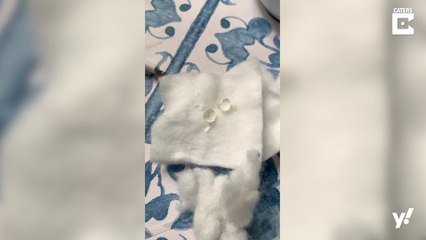 Überraschung: Frau brütet winzige Eier aus ...