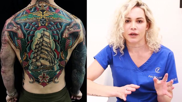 Removing Colour Tattoos - The Truth About Laser Tattoo Removal