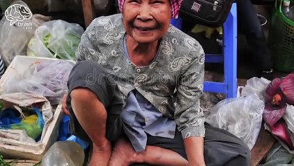 The world_s ugliest person to pay 1.5 million for his Plastic surgery _ Brain Facts(480P)