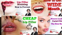 How To Get Red Lips Naturally-Lip Injections Before After