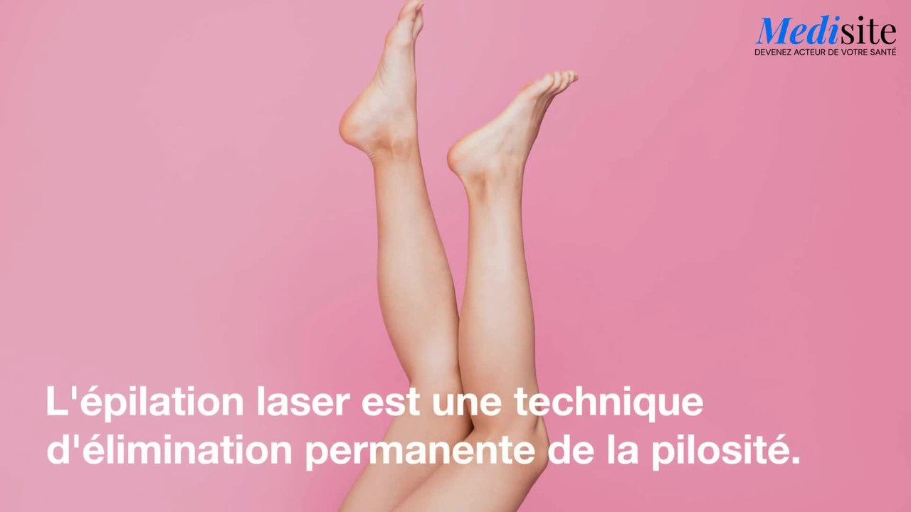 Epilation au laser : comment ça marche ?