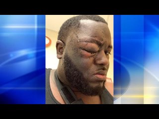 Lawyer claims NFL icon former Pitt star Aaron Donald beat up his client | Moon TV News