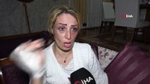İranlı mimar kadın eşinden öldüresiye dayak yedi... O anlar kamerada