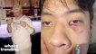 San Francisco Bar Review Bombed and Accused of Anti-Asian Racism After 18-Year-Old Beaten