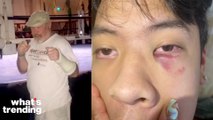 San Francisco Bar Review Bombed and Accused of Anti-Asian Racism After 18-Year-Old Beaten