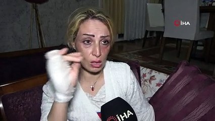 İranlı mimar kadın, "Seni öldürsem de ben ceza yemem" diyen eşi tarafından darp edildi