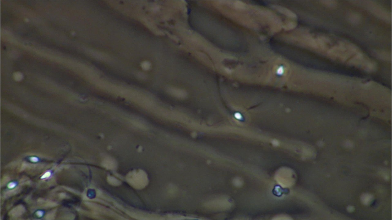 Is Semen Retention Really That Beneficial?