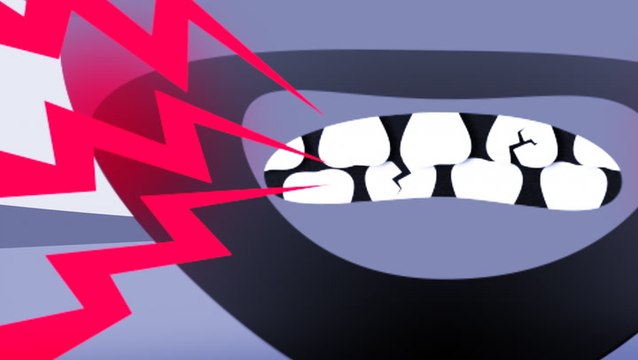 What happens if you grind your teeth too much