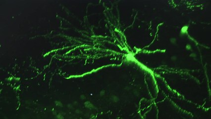 손상된 뇌 회복 방해하는 물질 발견...치료 길 열었다 / YTN