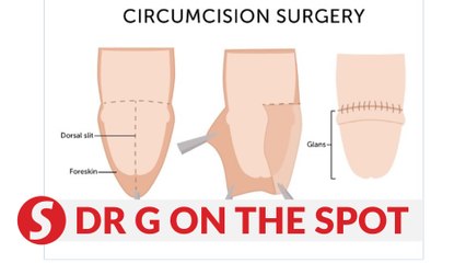 EP63: Three ways of skinning your penis | PUTTING DR G ON THE SPOT