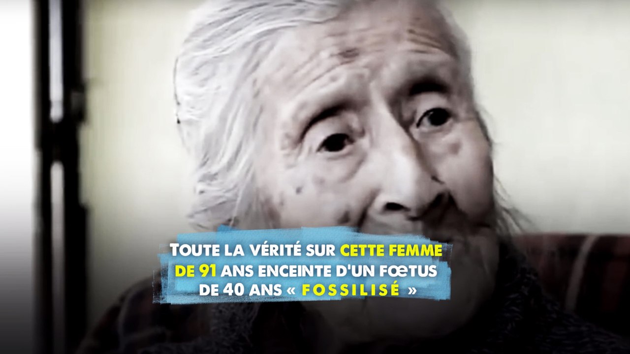 Toute la vérité sur cette femme de 91 ans enceinte d’un fœtus de 40 ans « fossilisé »