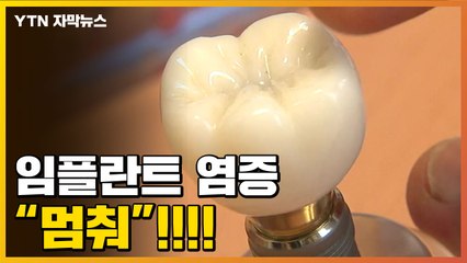 [자막뉴스] 임플란트 '염증' 부작용, 이제는 안녕! / YTN