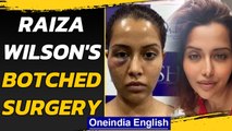 Raiza Wilson face swells after botched procedure | Oneindia News