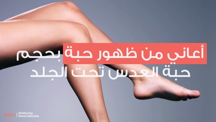 أعاني من ظهور حبة بحجم حبة العدس تحت الجلد