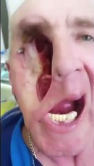 Görenleri hayrete düşüren protez yüzlü adam