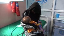 الأمم المتحدة: أكثر من 16 مليون شخص في اليمن مهددون بالمجاعة