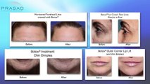 Why Botox After A Rhinoplasty Or Facial Surgery Should Wait Until Post-Surgical Swelling Resolves