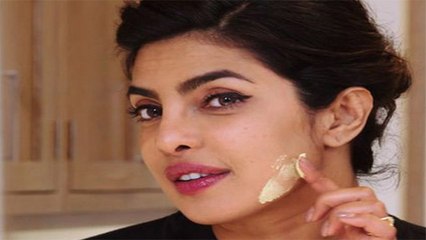 Priyanka Chopra का Sunburn हटाने का जबरदस्त तरीका | Sunburn Remedies | Boldsky