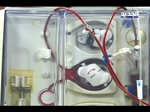 تقنية جديدة لغسيل الكلى في مستشفى المشرق - -تقرير الين حلاق