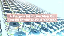 A Herpes Infection May Be Linked to the COVID Vaccine—Here's Why You Shouldn't Panic