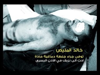 الطب الشرعي يكشف: هذا ما جرى في عرسال