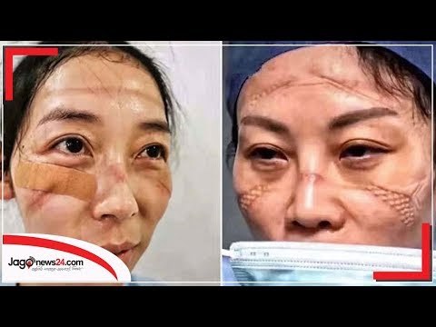 চীনের ডাক্তার নার্সদের মুখের দিকে তাকানো যাচ্ছে না | Jagonews24.com