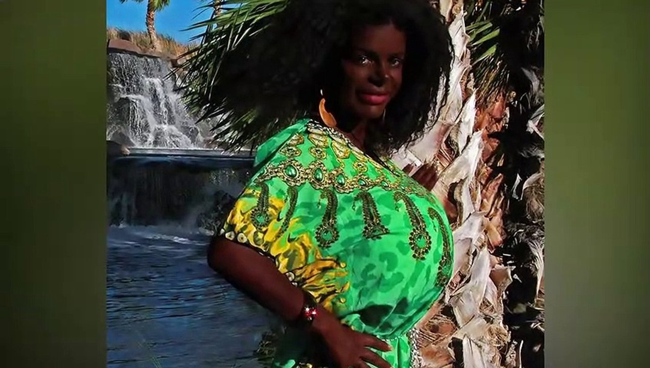 Plastic Surgery Before And After | People Who Took Plastic Surgery To Next Level | Plastic Surgery