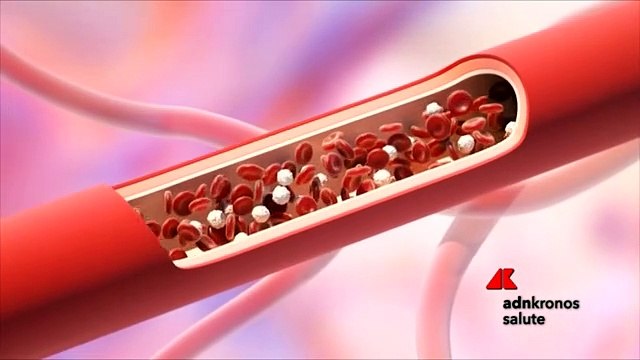 Da Novartis due nuove opzioni terapeutiche contro la sclerosi multipla
