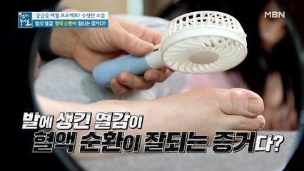 후끈한 발의 열감, 혈관 건강의 적신호다?