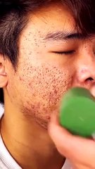 New Green Mask instant Effect Remove Pores