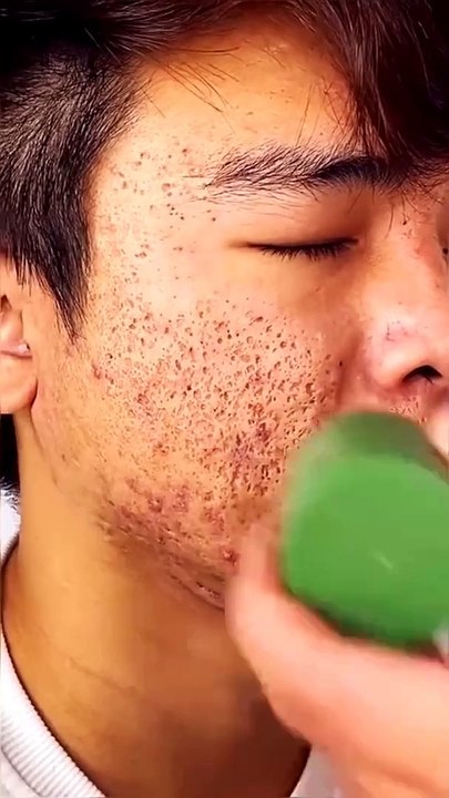 New Green Mask instant Effect Remove Pores