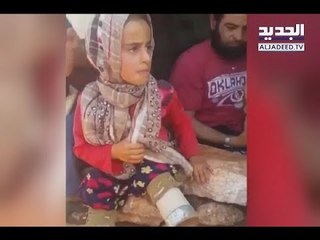 طفلة سورية نازحة تستخدم آنيةً معدِنية كأطراف صناعية