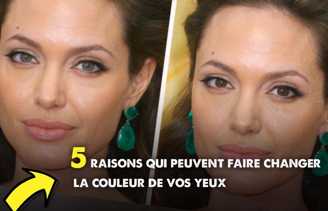 5 raisons qui peuvent faire changer la couleur de vos yeux