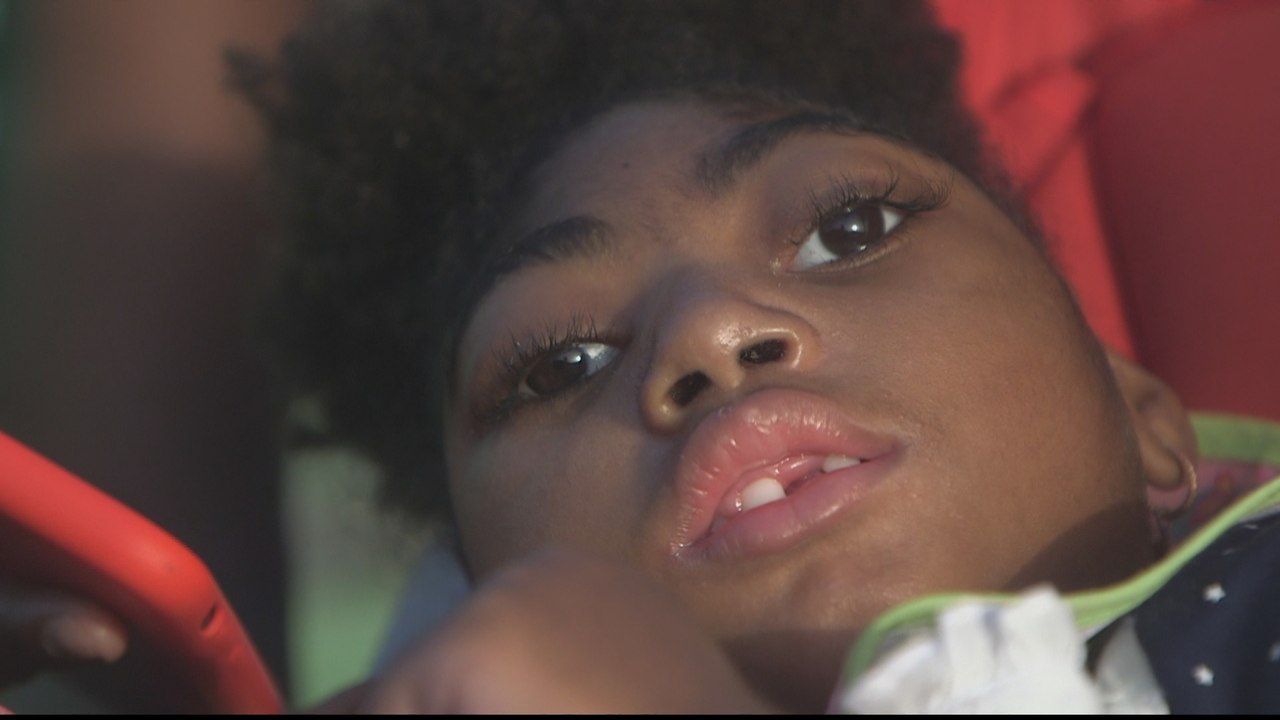 Cape Verde: Children with disabilities linked t...