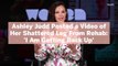 Ashley Judd Posted a Video of Her Shattered Leg From Rehab: 'I Am Getting Back Up'