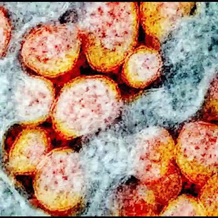 #Covid19Updates ಕರ್ನಾಟಕ: ರಾಜ್ಯದಲ್ಲಿ ಇಂದು 29744 ಜನರಿಗೆ ಸೋಂಕು | Oneindia Kannada