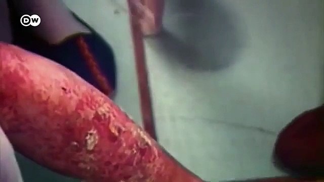 Chernóbil 35 años después del desastre nuclear DW Documental