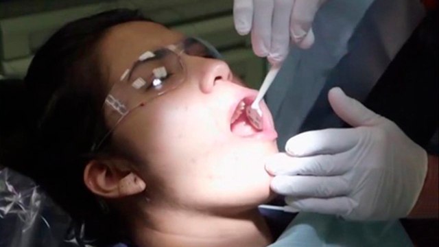 bd-dientes-con-tono-amarillo-causas-y-tratamientos-270421