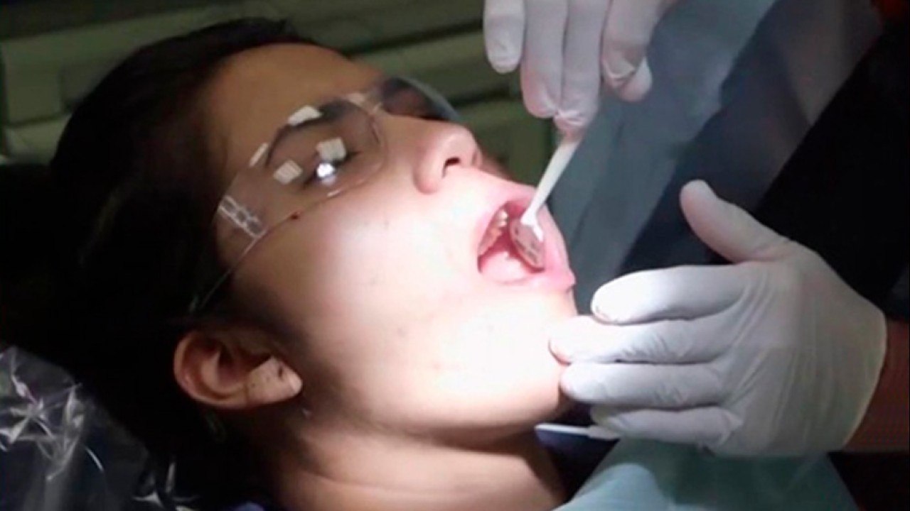 bd-dientes-con-tono-amarillo-causas-y-tratamientos-270421