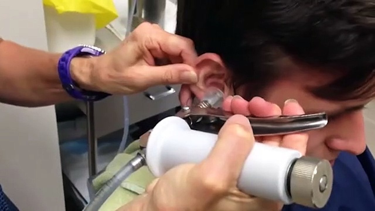 Bu videoyu izledikten sonra bir daha kulak çubuğu kullanmayacaksınız