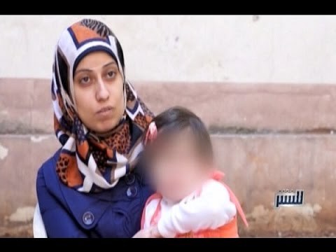 للنشر - طفلة ظهرت عليها علامات البلوغ