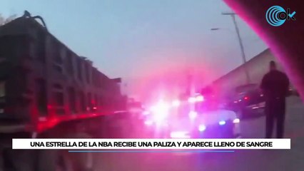 Una estrella NBA recibe una paliza y aparece lleno de sangre a las afueras de un club