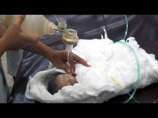 মৃত নবজাতক শিশুটি এখনও বেঁচে আছে | ‘Dead’ Newborn Baby is still Alive